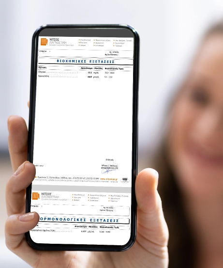 Παραλαβή Αποτελεσμάτων